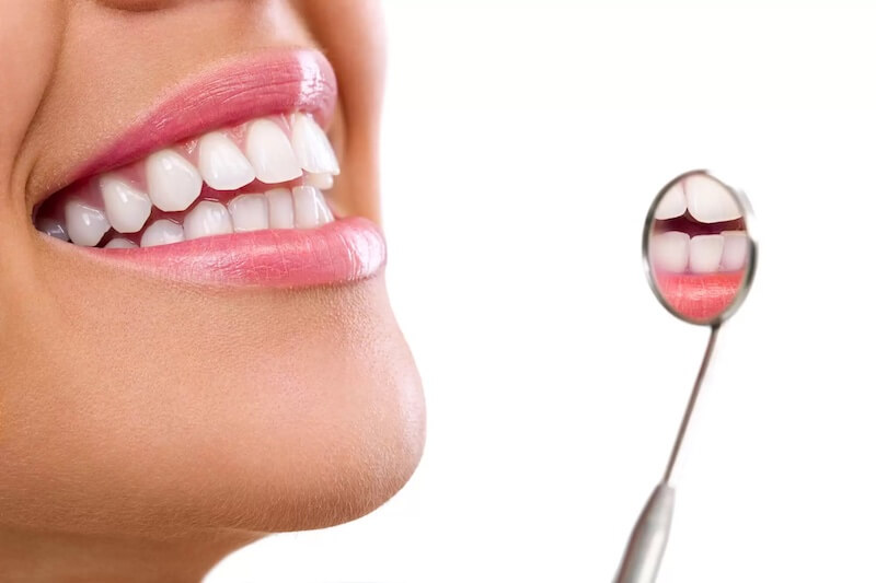 Top Causes of Gum Recession