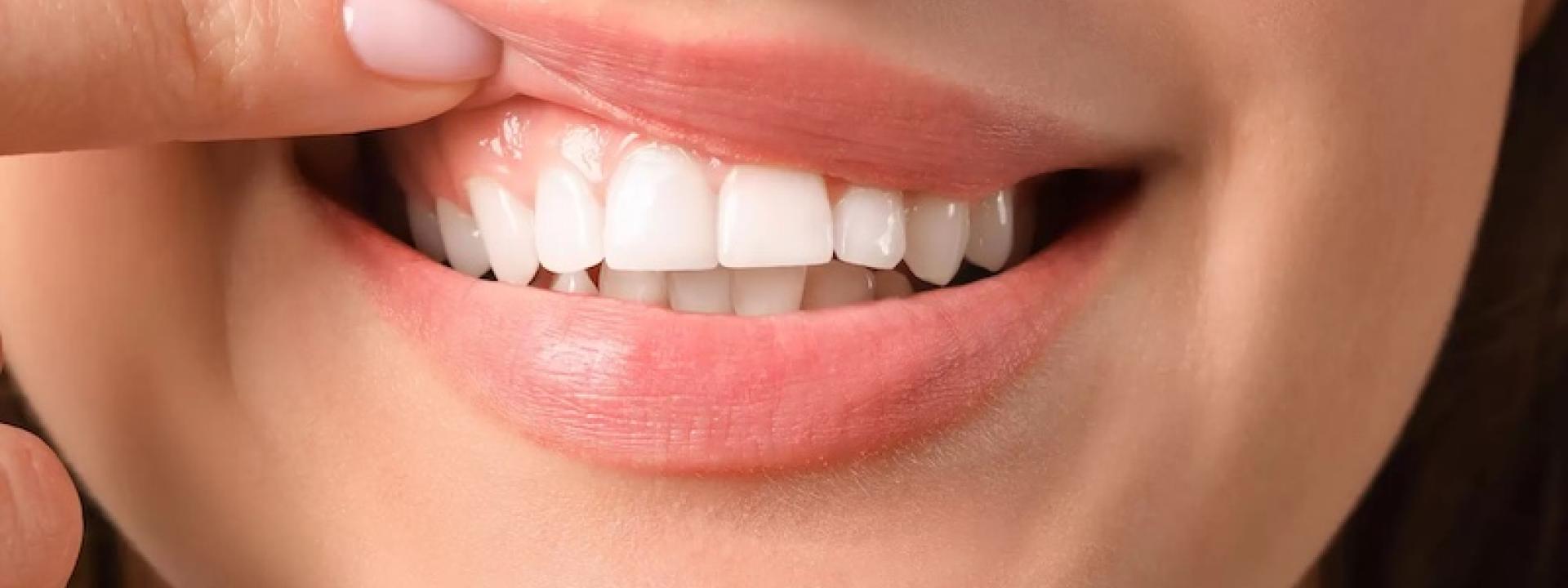woman-showing-healthy-gums.jpg